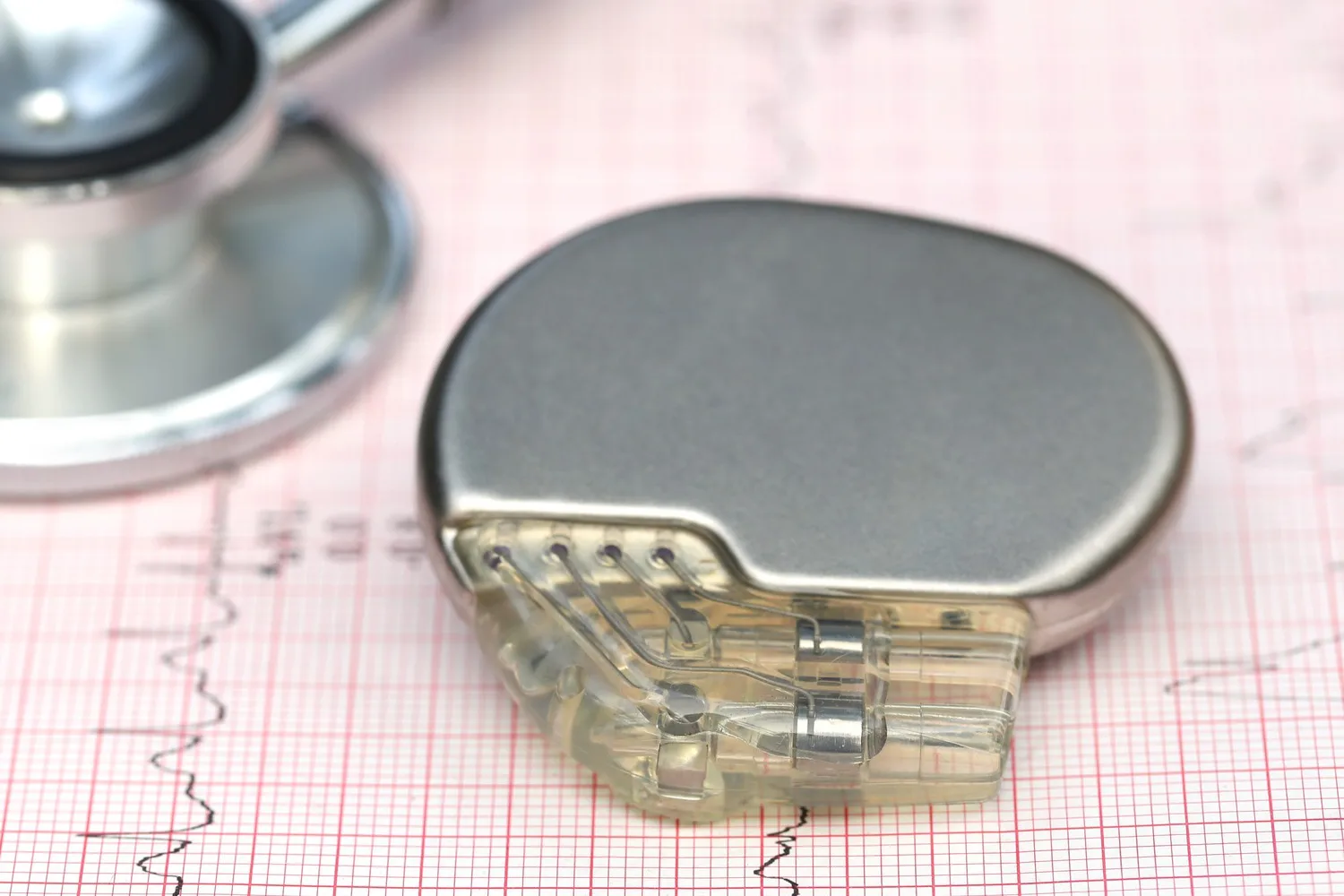 Implante de marcapasos definitivo